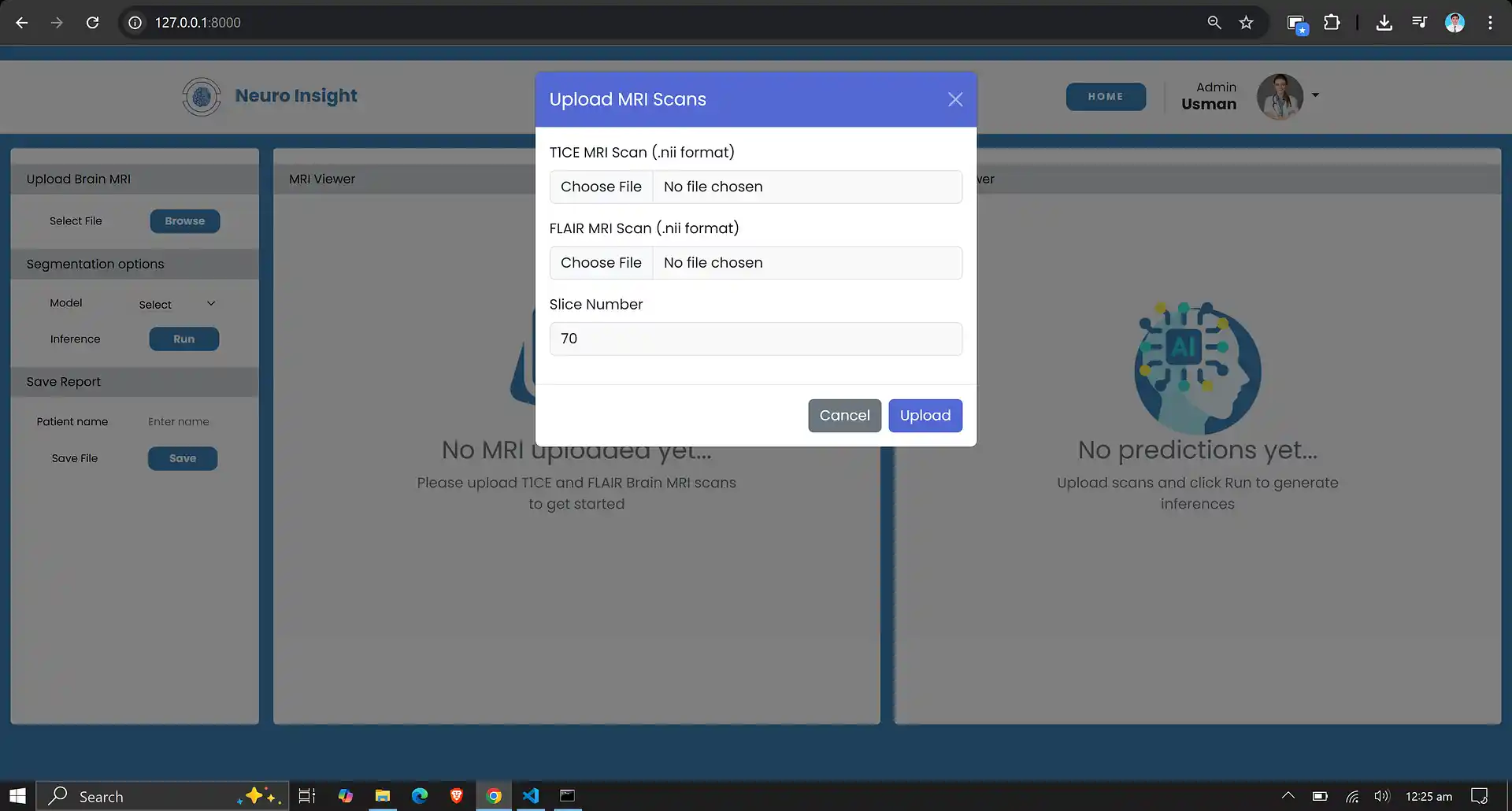 Modal to upload 3D MRIs
