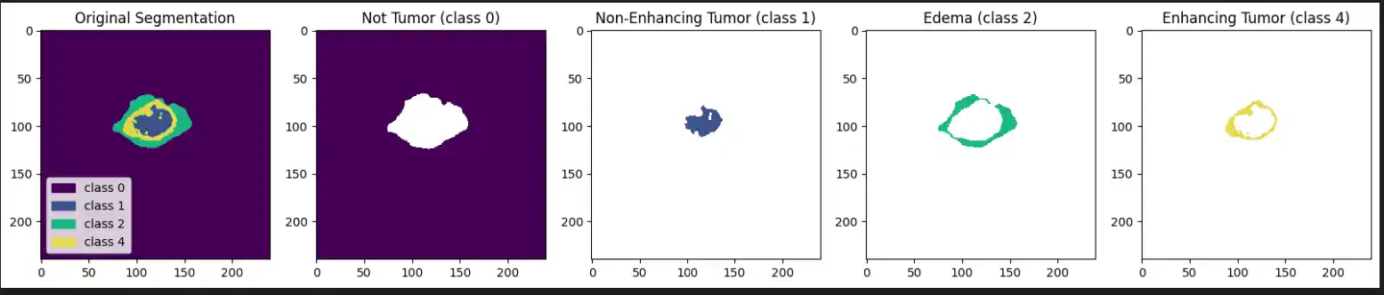 A sequence of masks breaking down the tumor into individual classes: Original Segmentation, Not Tumor, Non-Enhancing Tumor, Edema, and Enhancing Tumor